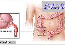 Nguyên nhân gây bệnh viêm đau ruột thừa