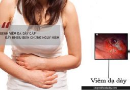 Bệnh viêm dạ dày cấp gây nhiều biến chứng nguy hiểm