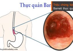 Bệnh Barrett thực quản